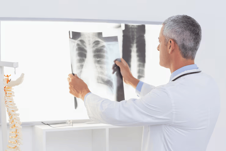 Digital X-ray