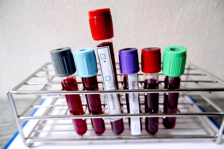 All type of specialized blood tests