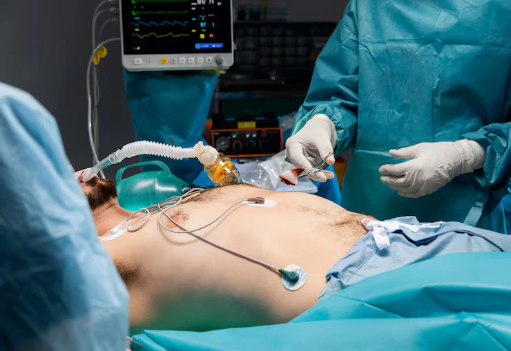 Femoral Hernia Repair 