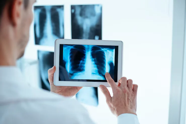 Chest CT Scan