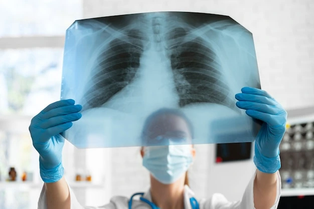 Digital X-Ray