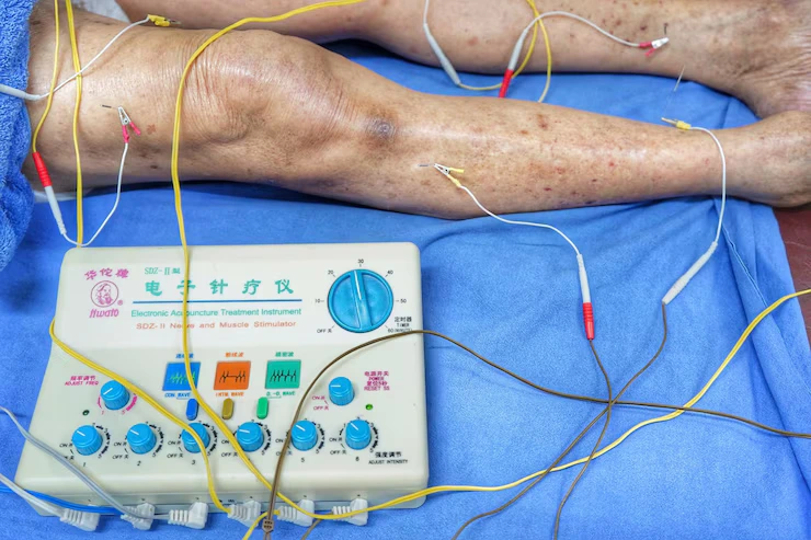 Nerve Conduction Studies