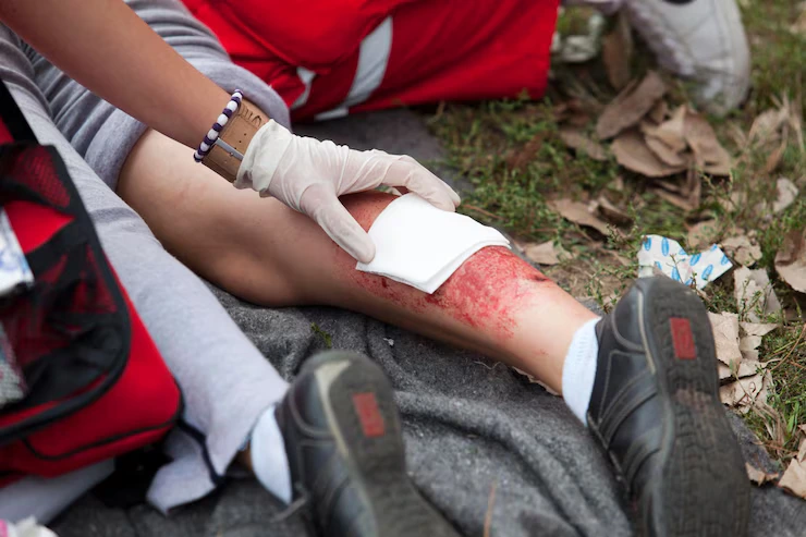 Burn and Trauma Reconstruction