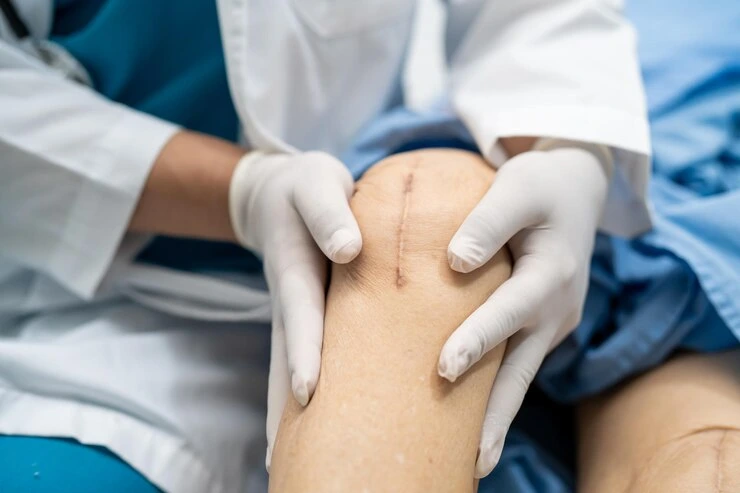 Scar Revision