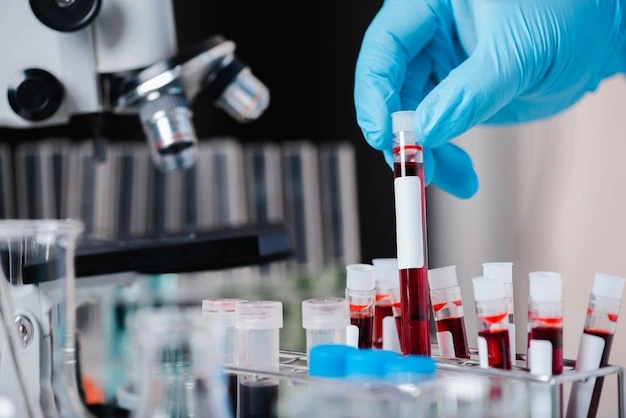 All type of blood tests