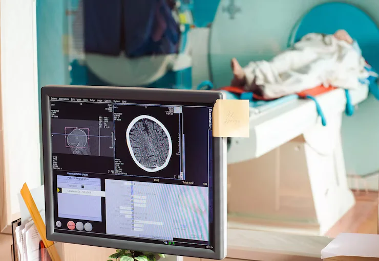 Brain & Head CT Scan