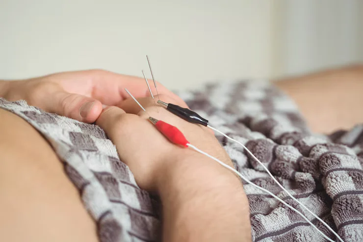 Dry Needling & Manual Therapy