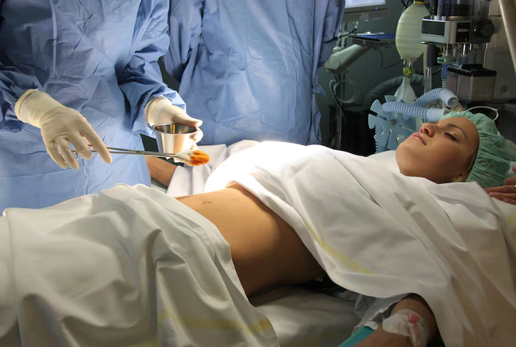 Emergency Appendectomy (24/7)