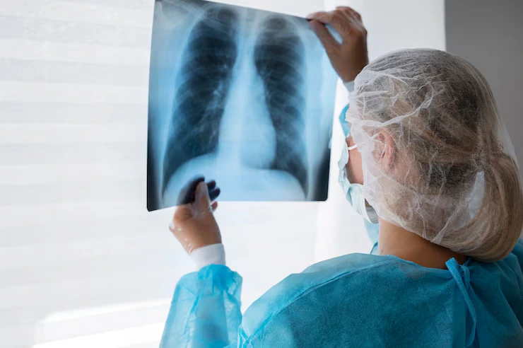 Digital X-Ray