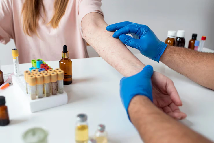 Allergy Testing & Treatment
