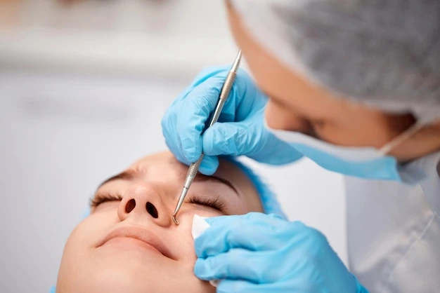 Endoscopic Sinus Surgery