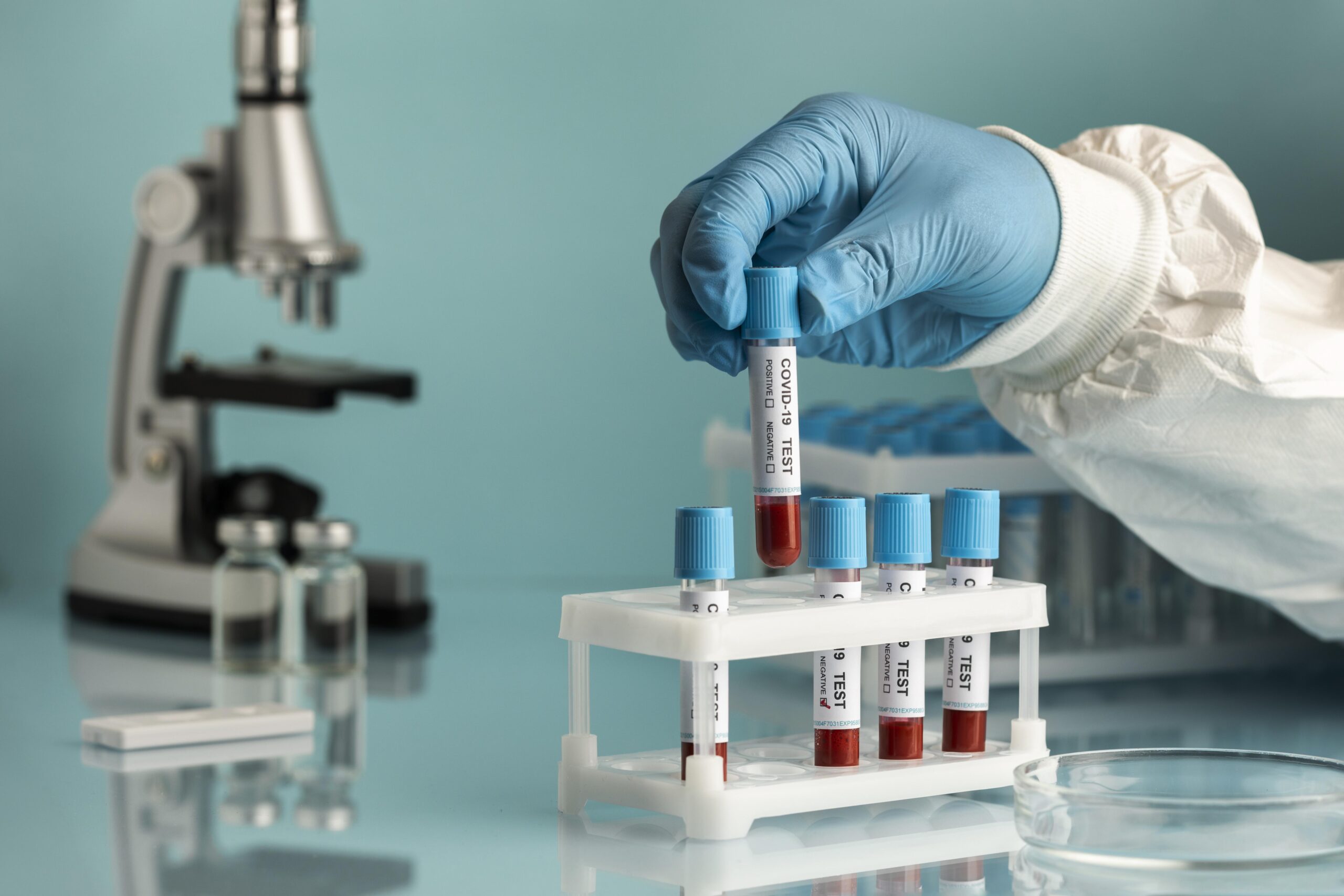 Mycobacteriology (TB Testing)