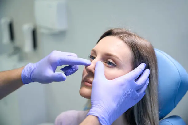 Rhinoplasty