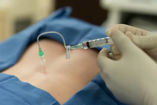 Nerve Blocks & Regional Anesthesia
