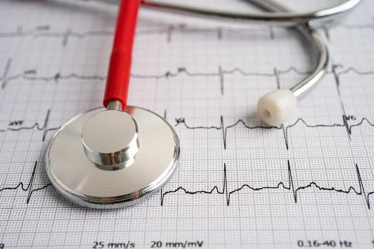 ECG