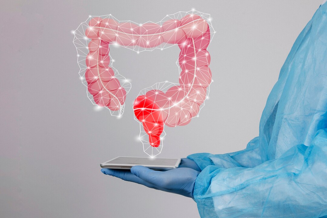 Anorectal Cancer Surgeries