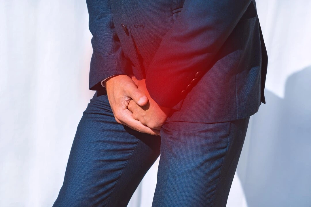 Piles (Haemorrhoids)