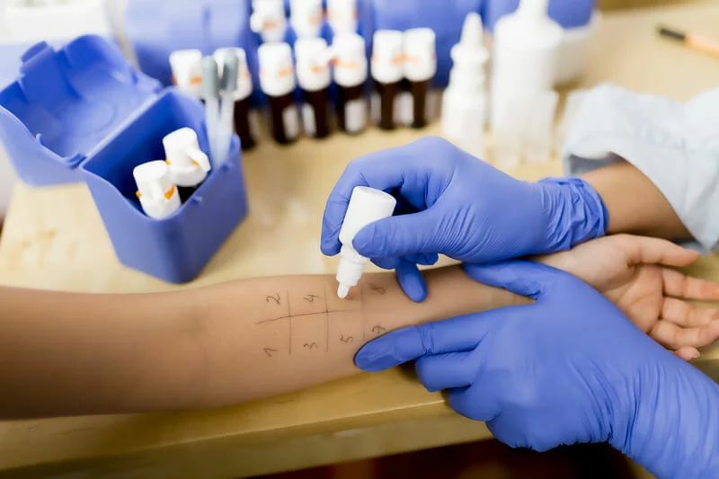 Allergy Clinic & Testing